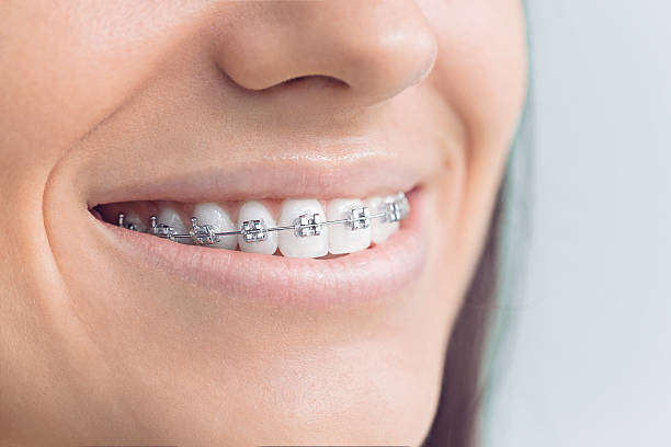 Best Cosmetic Dentistry  in Onalaska, TX